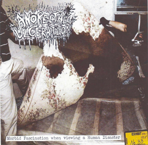 Anorectal Ulceration - Morbid Fascination When Viewing A Human Disaster (Vinyl)