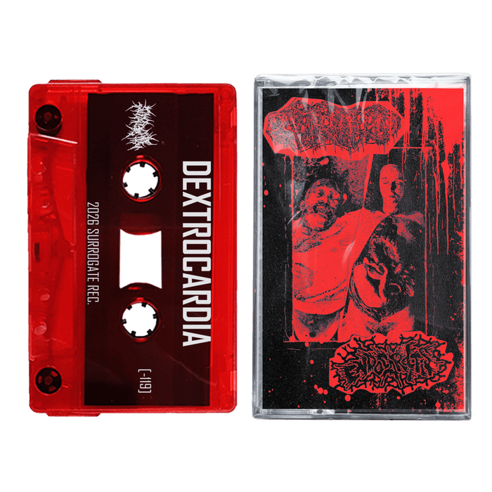 Dextrocardia / Endocarditis - Split (Cassette)