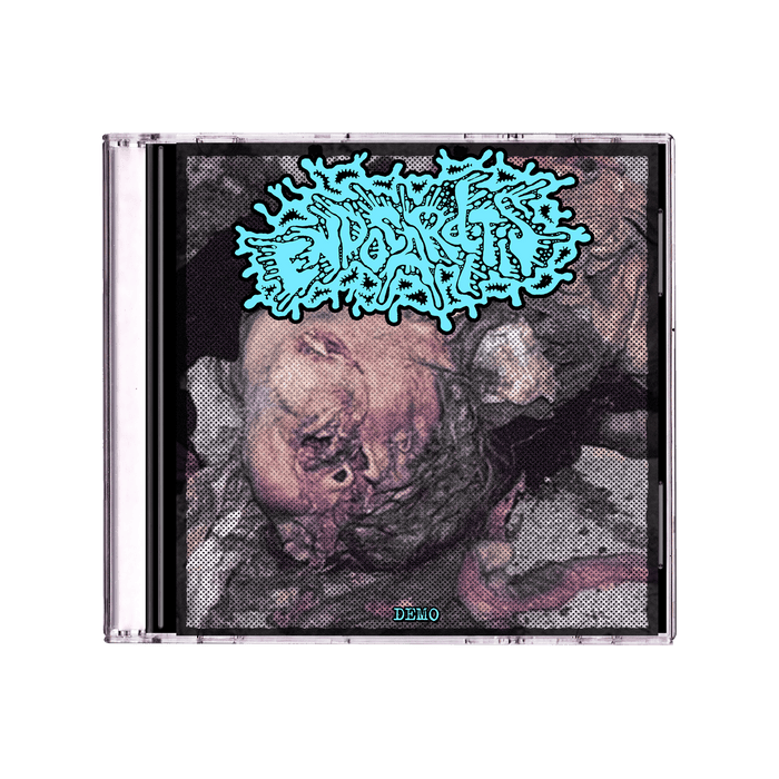 Endocarditis - Demo