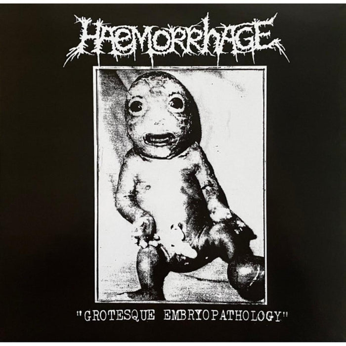 Haemorrhage - Grotesque Embryopathology