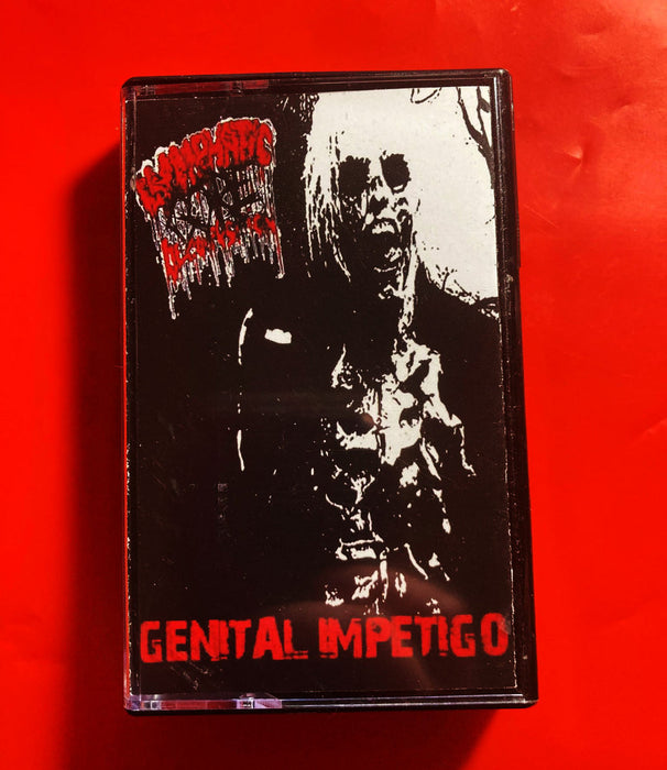 Lymphatic Gore Decomposition - Genital Impetigo (Cassette)