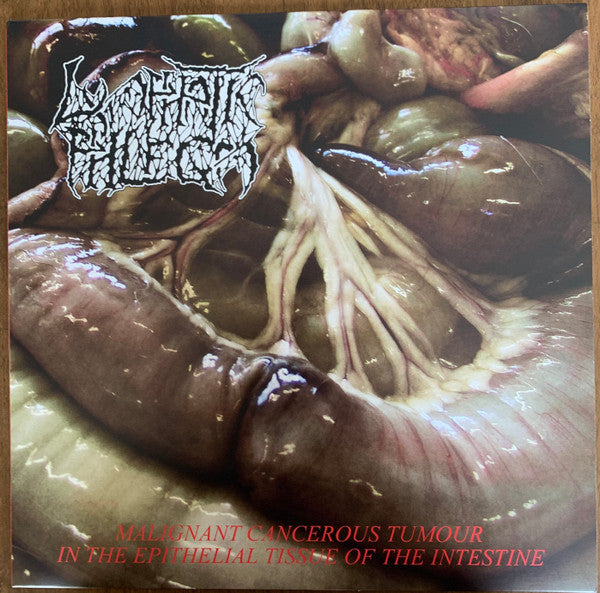 Lymphatic Phlegm / Flesh Grinder – Malignant Cancerous Tumour In The Epithelial Tissue Of The Intestine / From Rotten Process... To Anatomy (Vinyl)