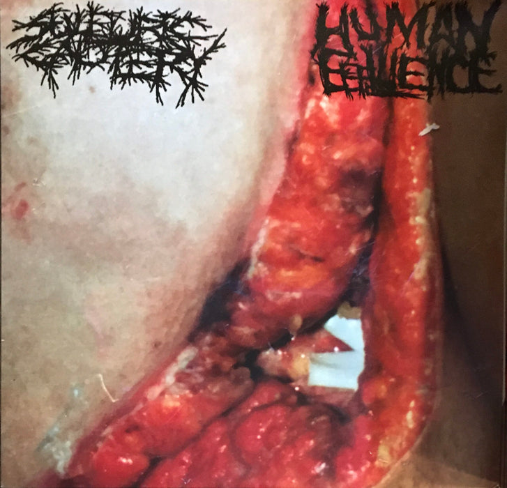 Sulfuric Cautery / Human Effluence - Split (Vinyl)