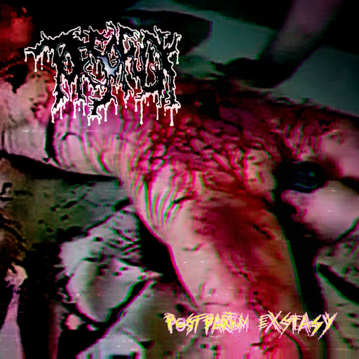 Torsofuck - Postpartum Exstasy (Vinyl)