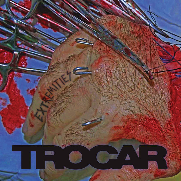 Trocar - Extremities