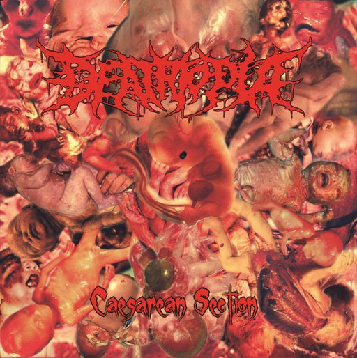 Deathtopia - Caesarean Section (Vinyl)
