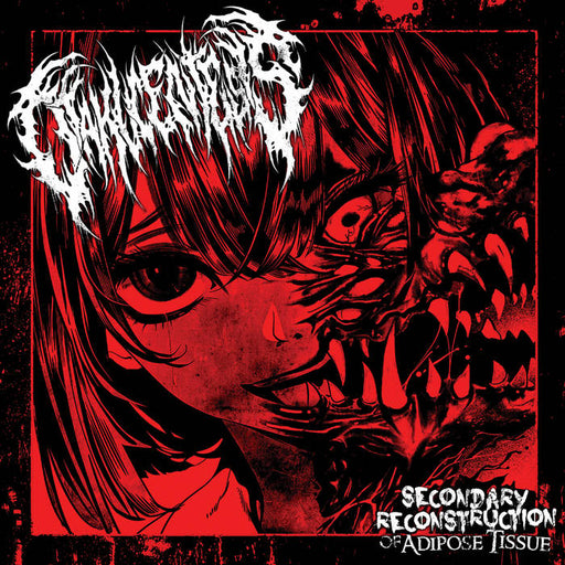 Otakucentesis - Secondary Reconstruction Of Adipose Tissue