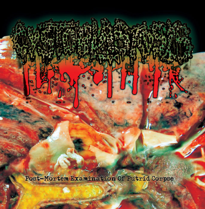 Cystoblastosis - Post-Mortem Examination Of Putrid Corpse