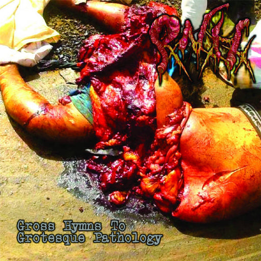 Pancreatite Necro Hemorragica - Gross Hymns To Grotesque Pathology