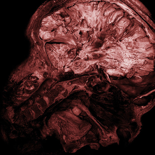 Thanatopsis - Stages of Decomposition
