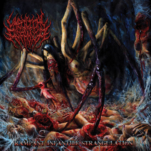 Umbilical Asphyxia - Rampant Infantile Strangulation